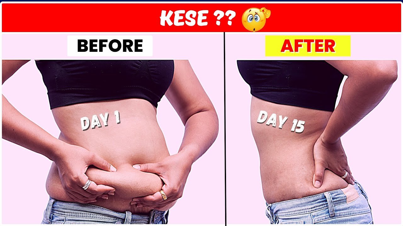 Trim tummy-Visible changes